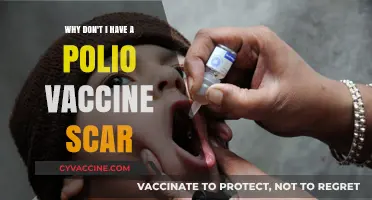 Understanding the Absence of Polio Vaccine Scars: Modern Vaccination Methods Explained
