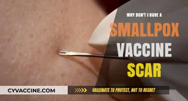 Smallpox Vaccine Scars: Why Don't I Have One?