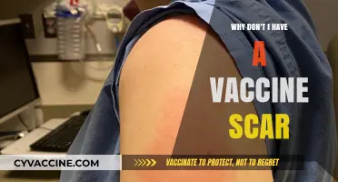 No Vaccine Scar? Understanding the Science Behind Immunization Marks