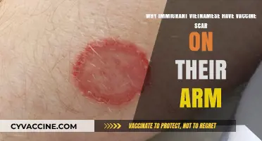 Vaccine Scars on Vietnamese Immigrants: A Tale of Resilience and History