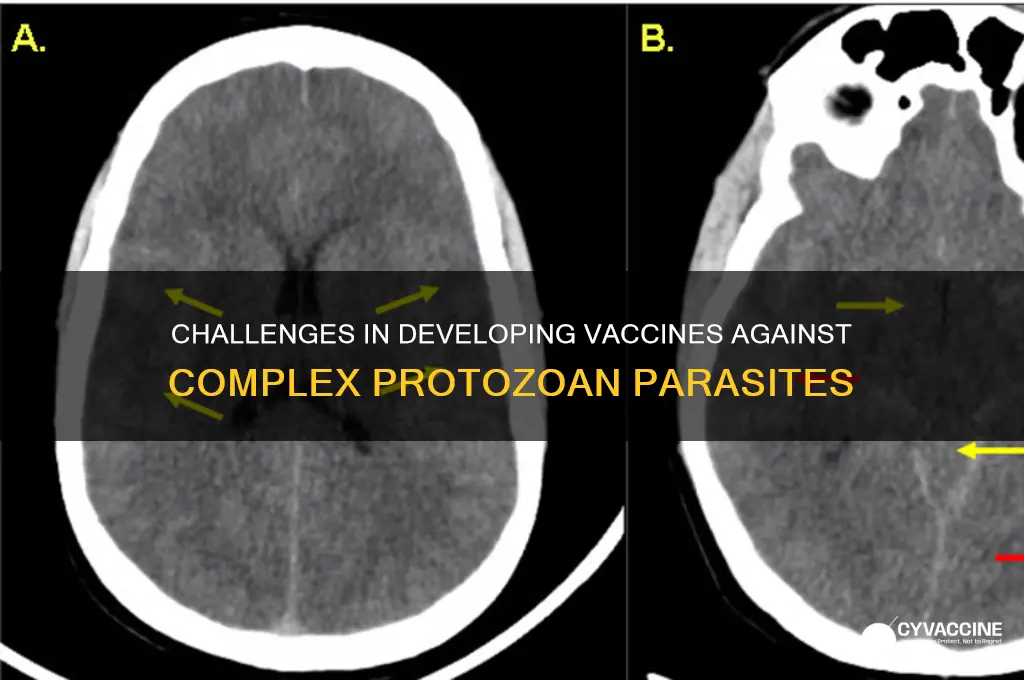 why is it difficult to design vaccinations against protozoan organisms