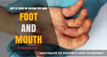 The Mystery of Hand, Foot and Mouth: Vaccine Elusive